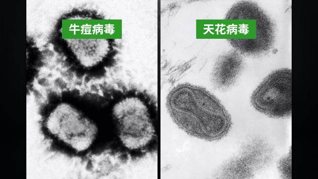 殺死5億人的病毒，3000年人類束手無策，卻被鄉村醫生的疫苗終結