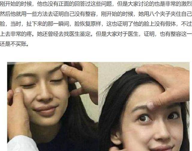 顏值改變是因為整牙？童顏女神新垣結衣的話，讓我想起了楊穎