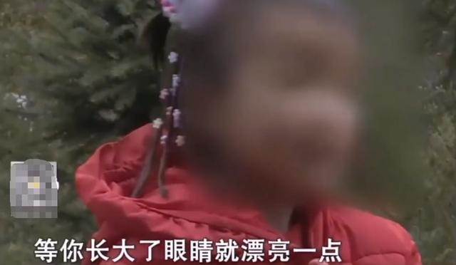 高齡孕婦40歲生下獨眼寶寶，天生只有一顆眼球，母親甘心為女捐眼