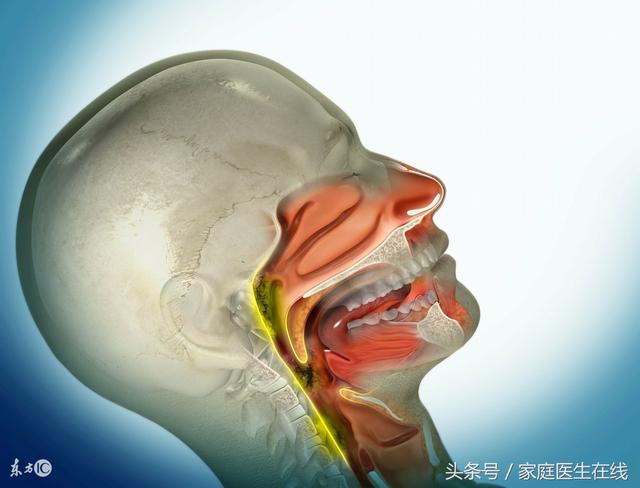 身体上有这5种表现,已经暗示咽喉癌的到来!很多人都错过了