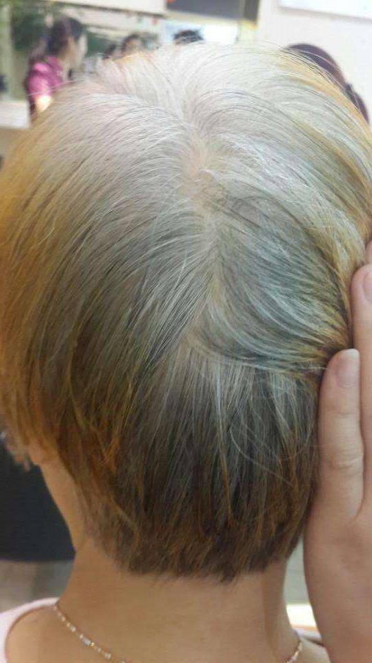 白发别急著染,用几块钱的小偏方就能根治